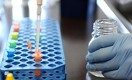 «Ученые не знают, как чума «обманывает» иммунитет человека»